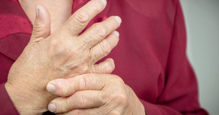 woman massages her own hand _ rheumatoid arthritis