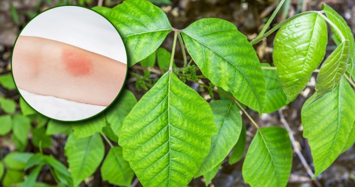 Close-up of poison ivy plant and an arm that shows skin irritants with a red rash