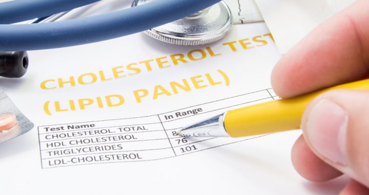 printout of total cholesterol numbers